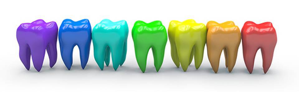 Was darf Zähne bleichen kosten?