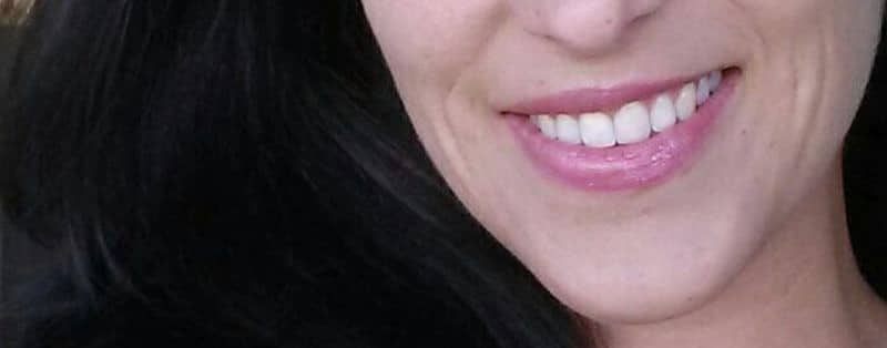 Ästhetische Zahnheilkunde Artikelbild